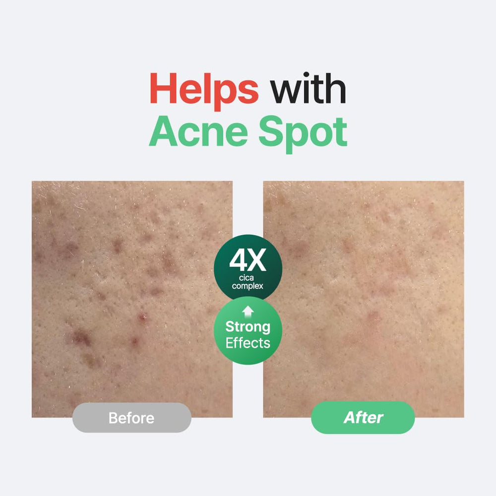 PURITO Centella Sans Parfum – texture légère pour absorption rapide.