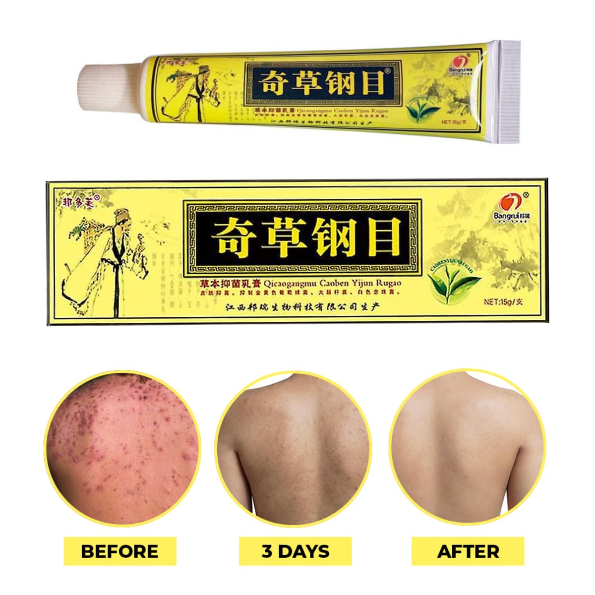 Application de la crème QICAOGANGMU sur une zone irritée.