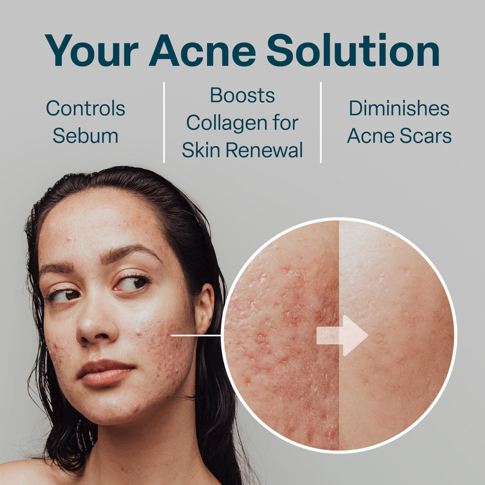 Formule avec glycolique 10% et salicylique 2% pour exfolier efficacement