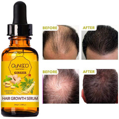 Huile essentielle de gingembre, actif dans le sérum QUNGCO.