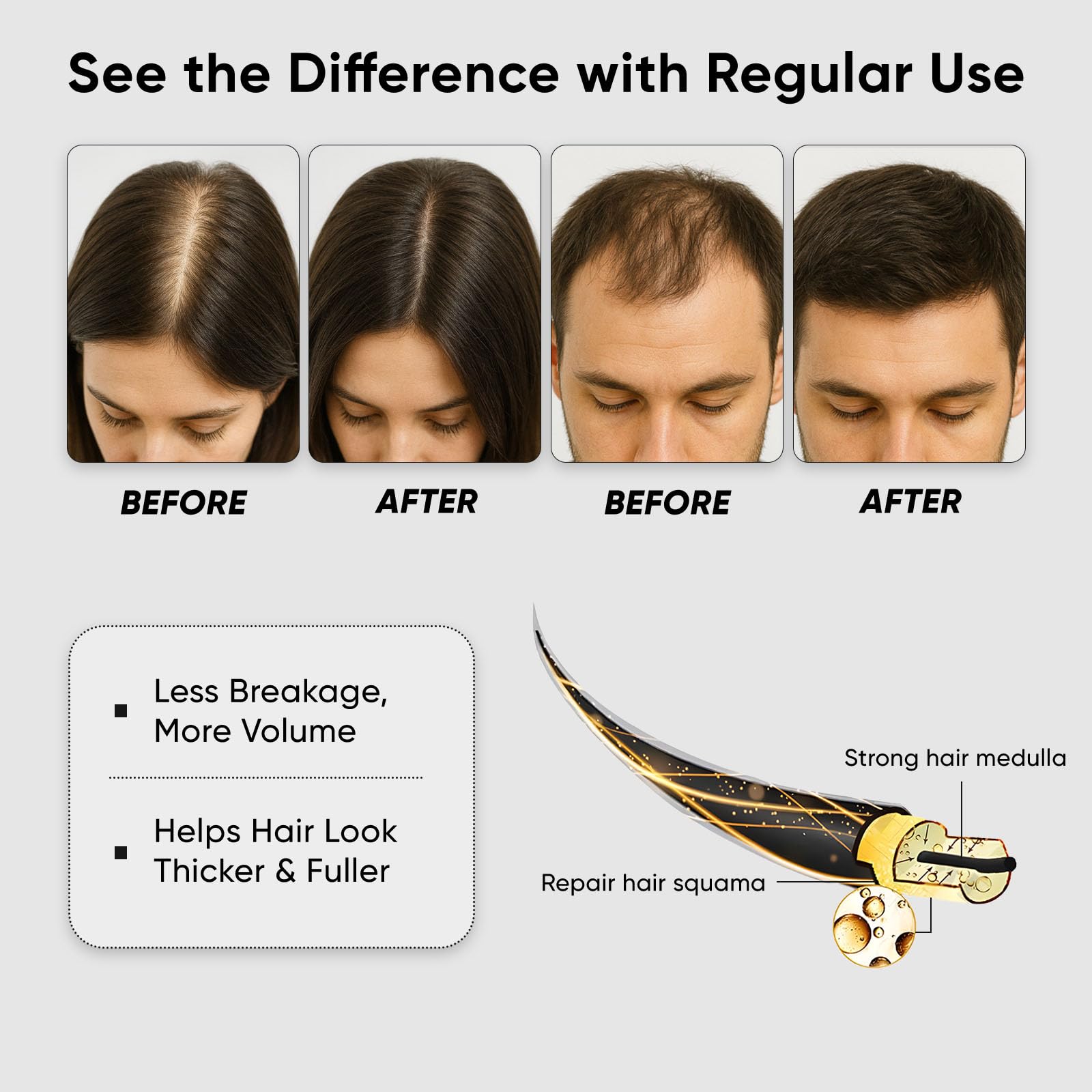QUZOYU Thicair, densité capillaire accrue pour cheveux plus épais.