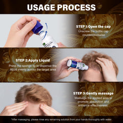 QYFJ Minoxidil: absorption rapide sans résidu gras sur le cuir chevelu.