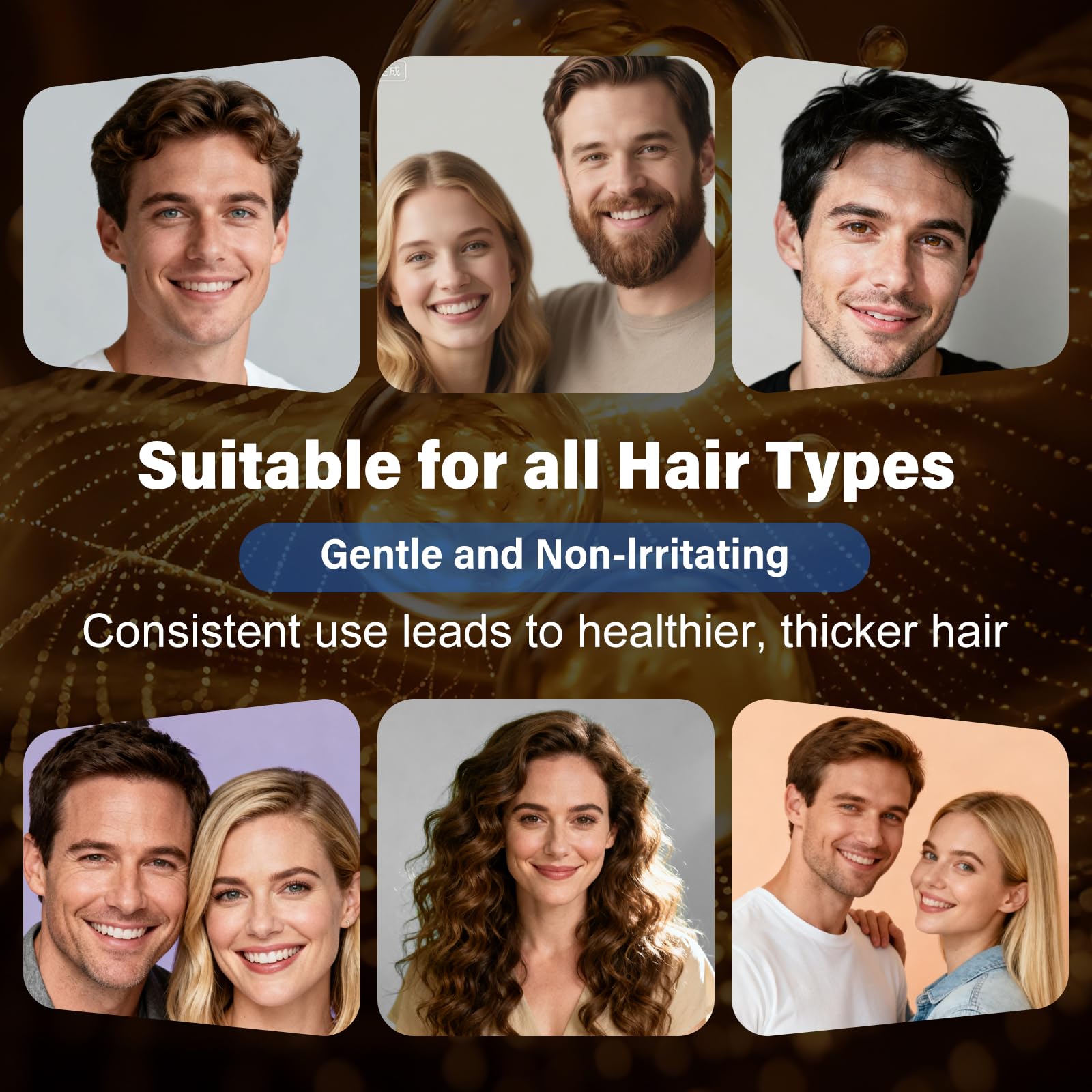 QYFJ Minoxidil: soin ciblé pour cuir chevelu clairsemé et barbe plus dense.