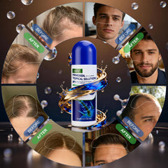 QYFJ Minoxidil: embout éponge pour éviter les coulures et optimiser l'absorption.