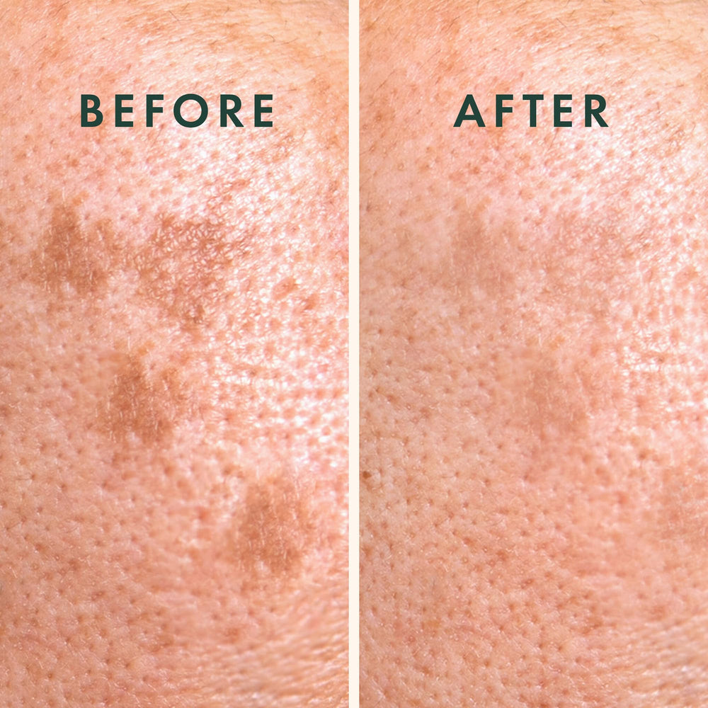 Glutathione 5% Rael, éclaire le teint ciblé.