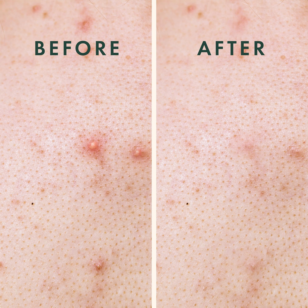 Patch Rael protège la peau des irritants externes