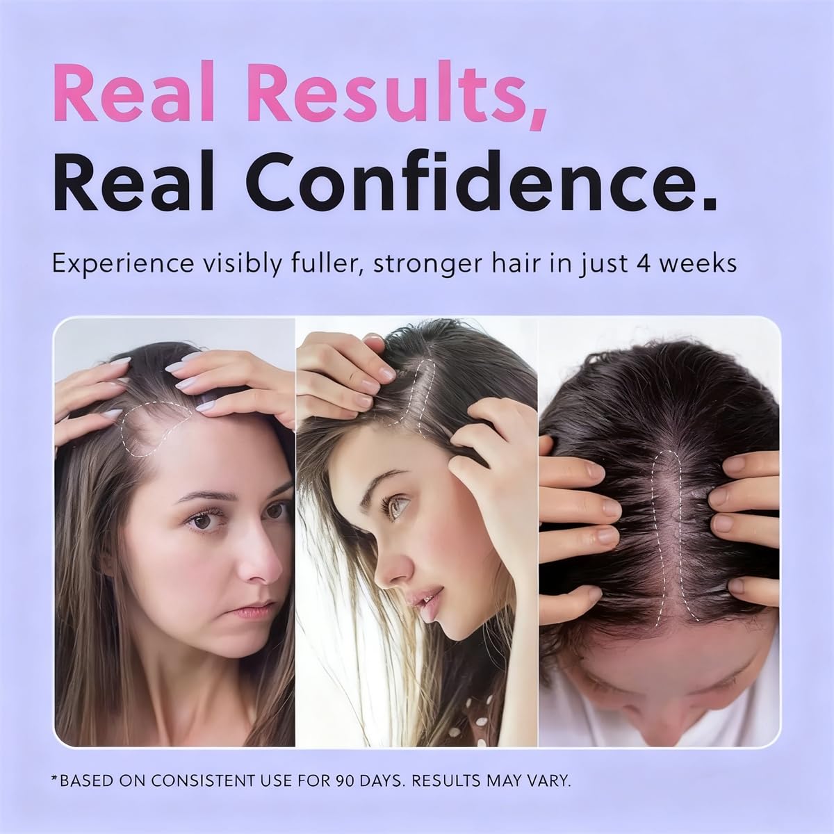 RAIFIN huile-croissance-capillaire sur cuir chevelu, massage doux pour revitaliser les racines.