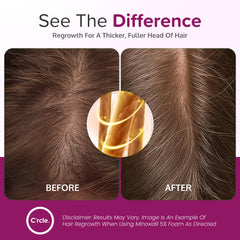 C'rcle Minoxidil pour femmes, cheveux visiblement plus épais