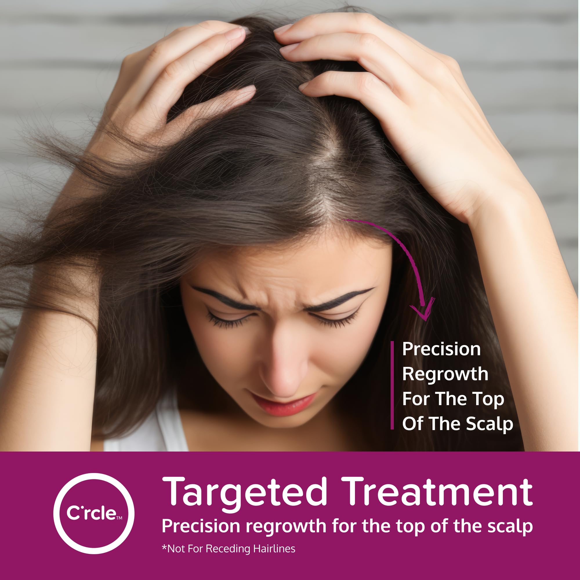 C'rcle Minoxidil pour femmes, résultats potentiels après quelques semaines