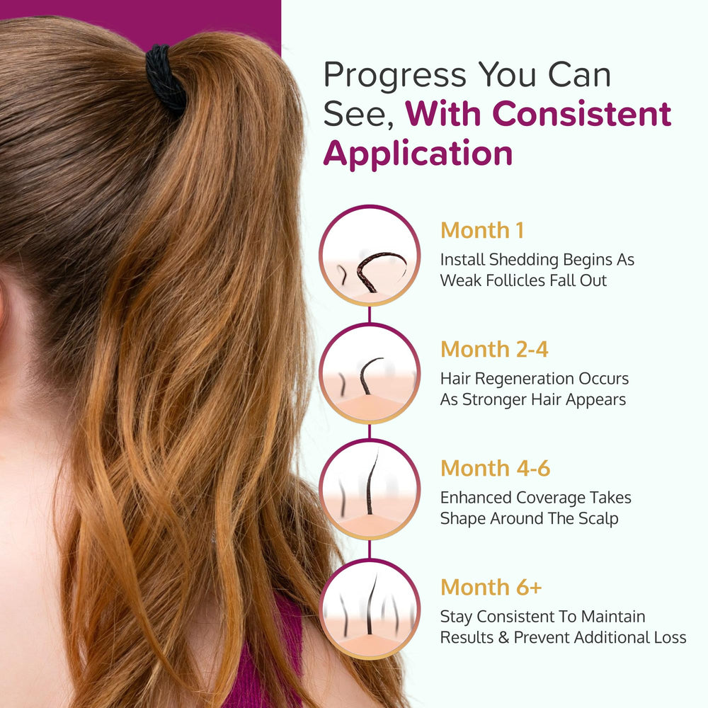 C'rcle Minoxidil pour femmes, soin capillaire non parfumé et confortable