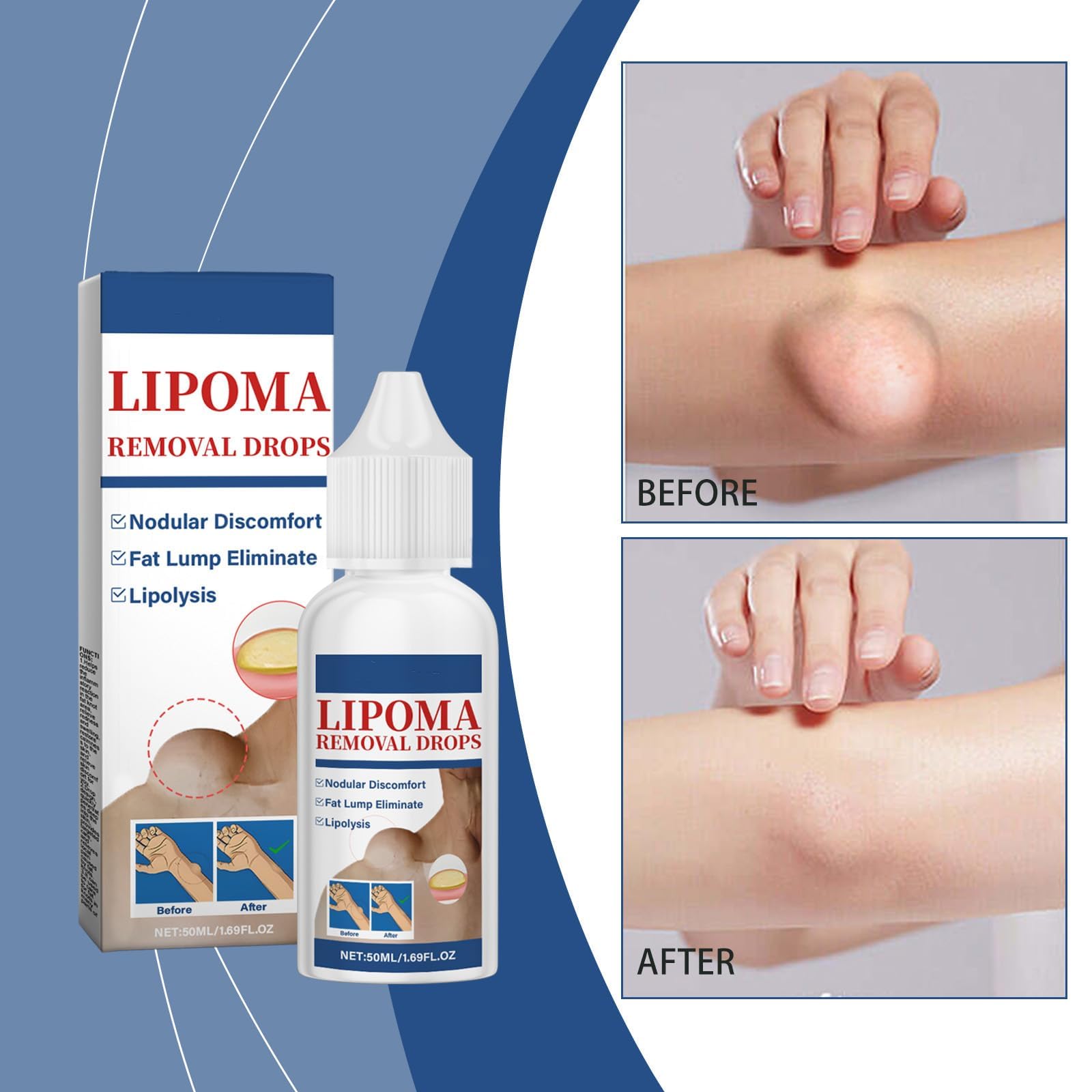 Application des gouttes lipome sur la peau pour un effet apaisant et rapide.