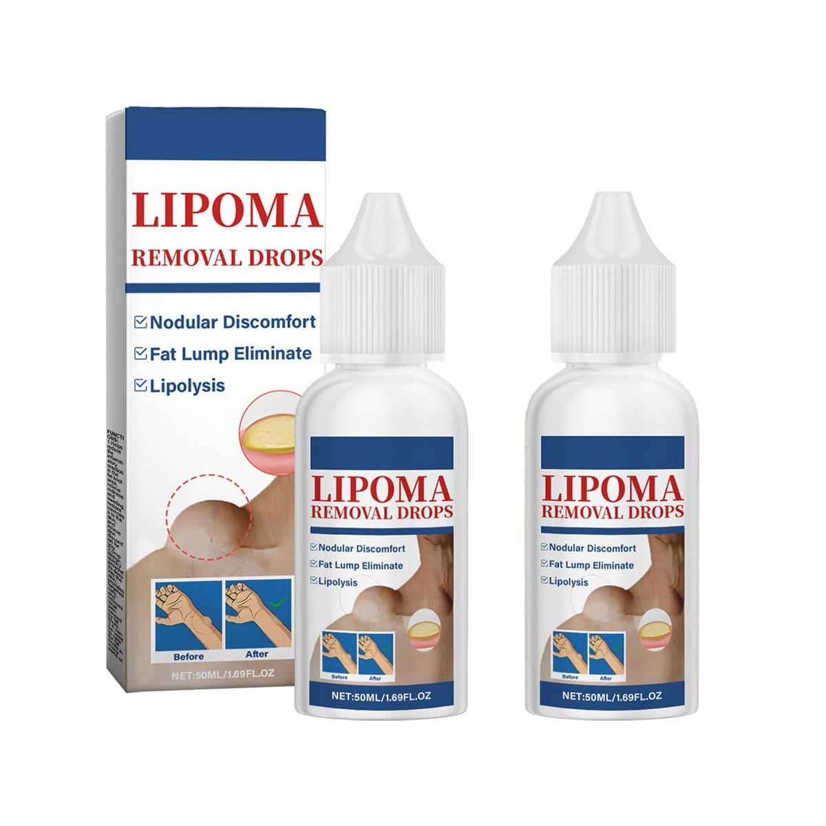 Gouttes lipome naturelles de RCSCBC dans un flacon 50 ml pour soin efficace.