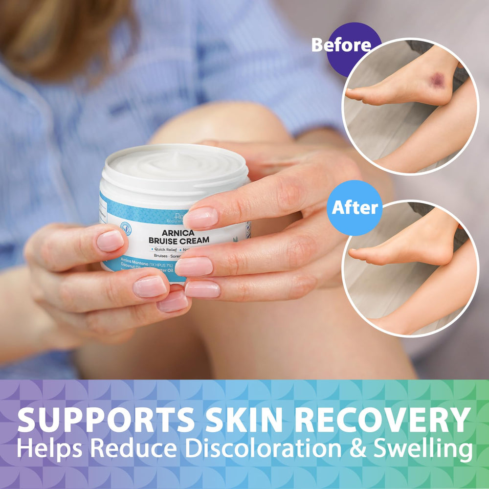 Crème Arnica Recuren Plus sans parabènes, formulation naturelle et douce