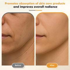 RedLOOK application-creme-yeux absorption optimisée grâce à l'appareil.