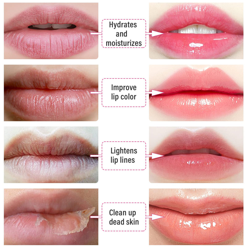 REENGULL masque-levres rose voyage: format pratique à emporter pour hydrater en déplacement.