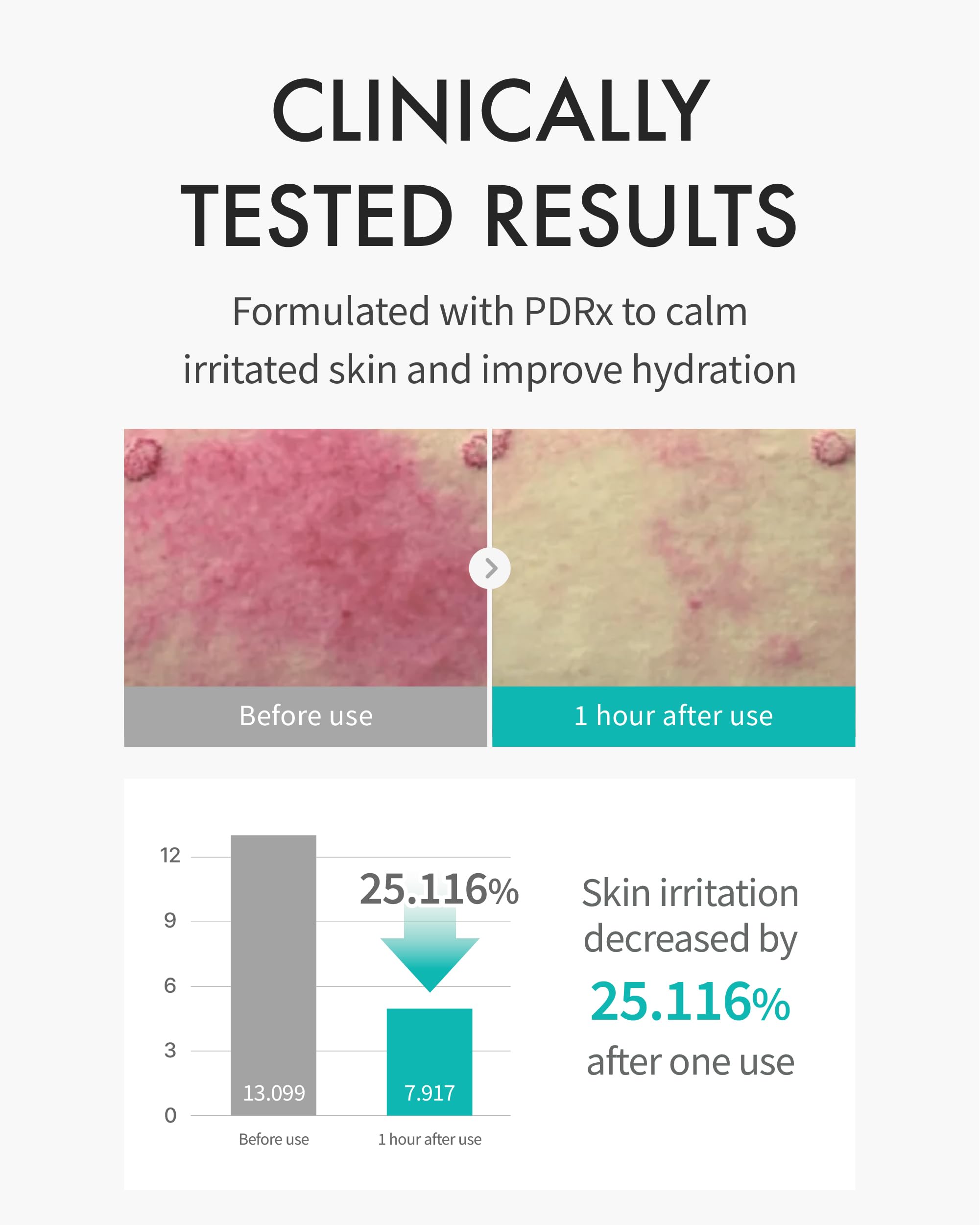 REJURAN Masque Hydratant PDRx — application visage qui épouse les contours