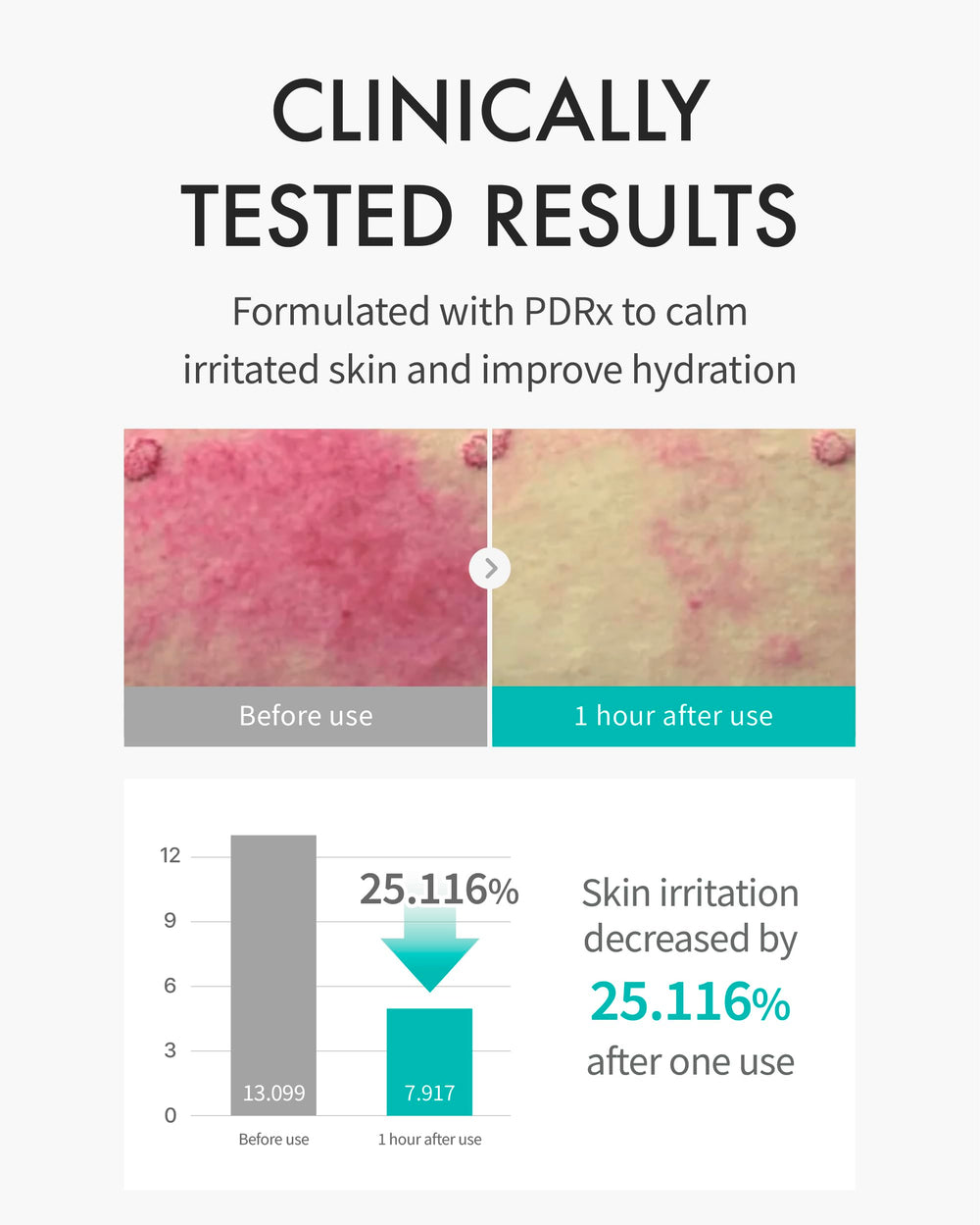 REJURAN Masque Hydratant PDRx — application visage qui épouse les contours