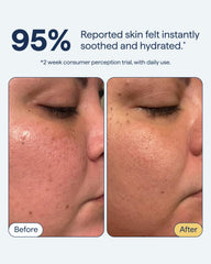 Remedy Science gel-cream texture close-up highlights fast-absorbing, non-sticky feel.