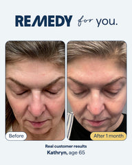 Remedy Science sérum anti-âge, pompe intégrée pour une utilisation précise.