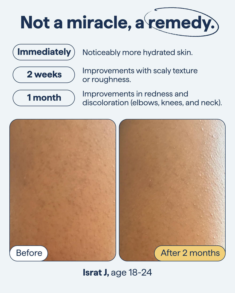 Remedy Science Urée Lactique Rétinol: exfoliation douce.
