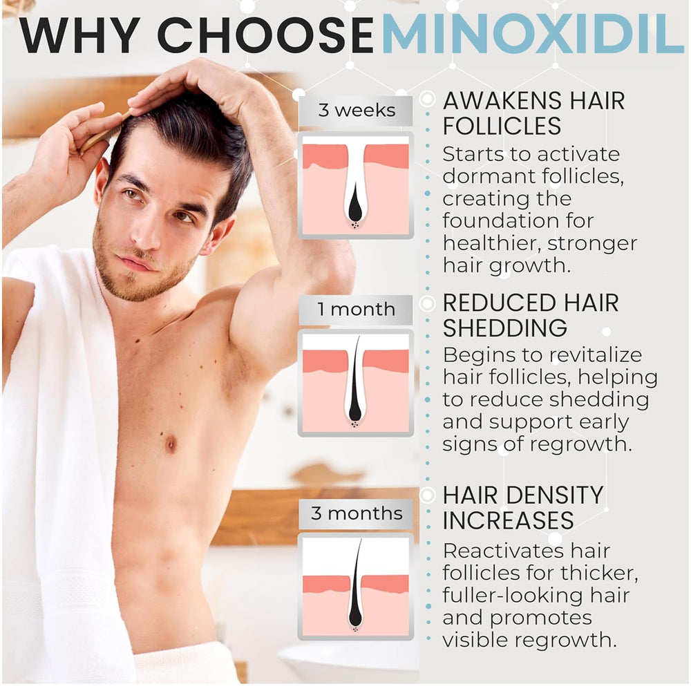 Remixidil Homme 5% Minoxidil Mousse, contact direct sur le cuir chevelu.