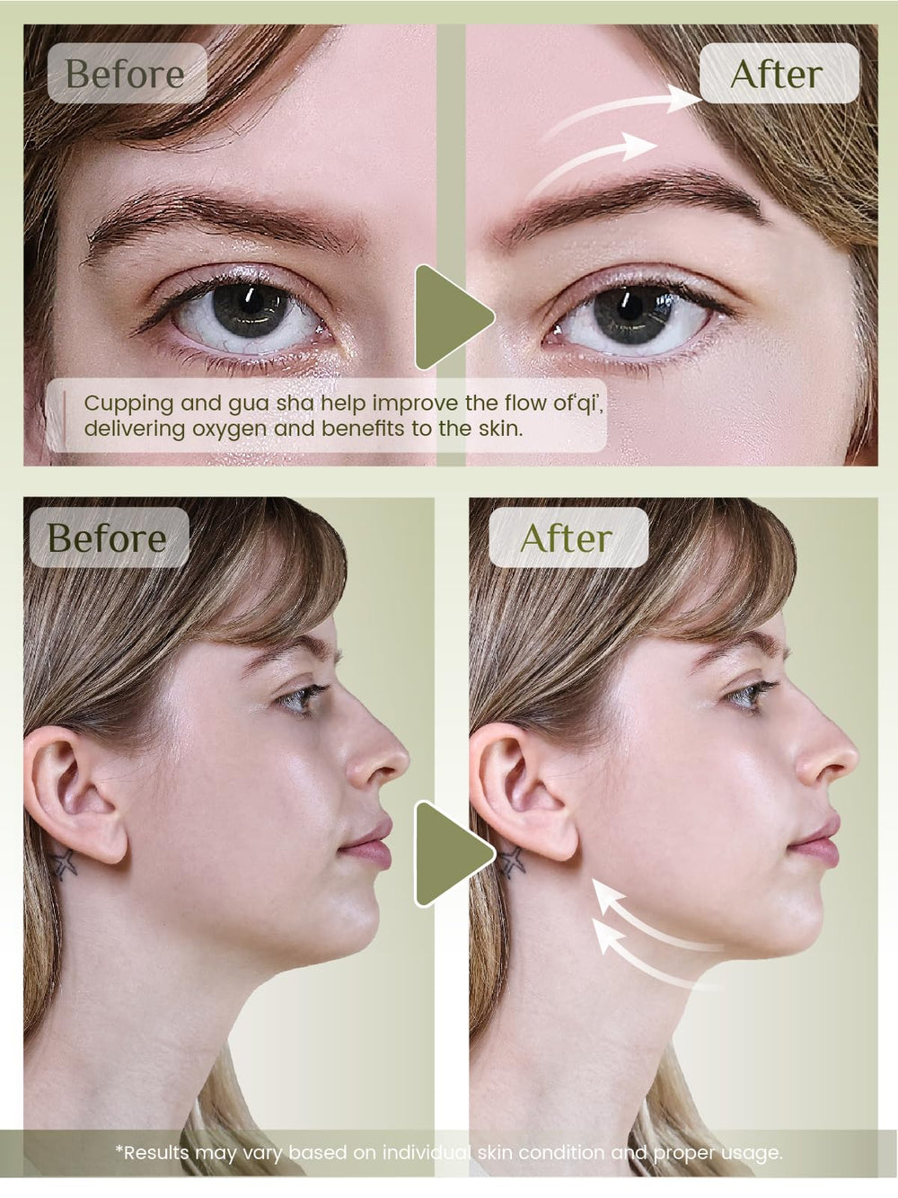 Rena Chris ensemble de 4 outils cupping visage, différentes tailles