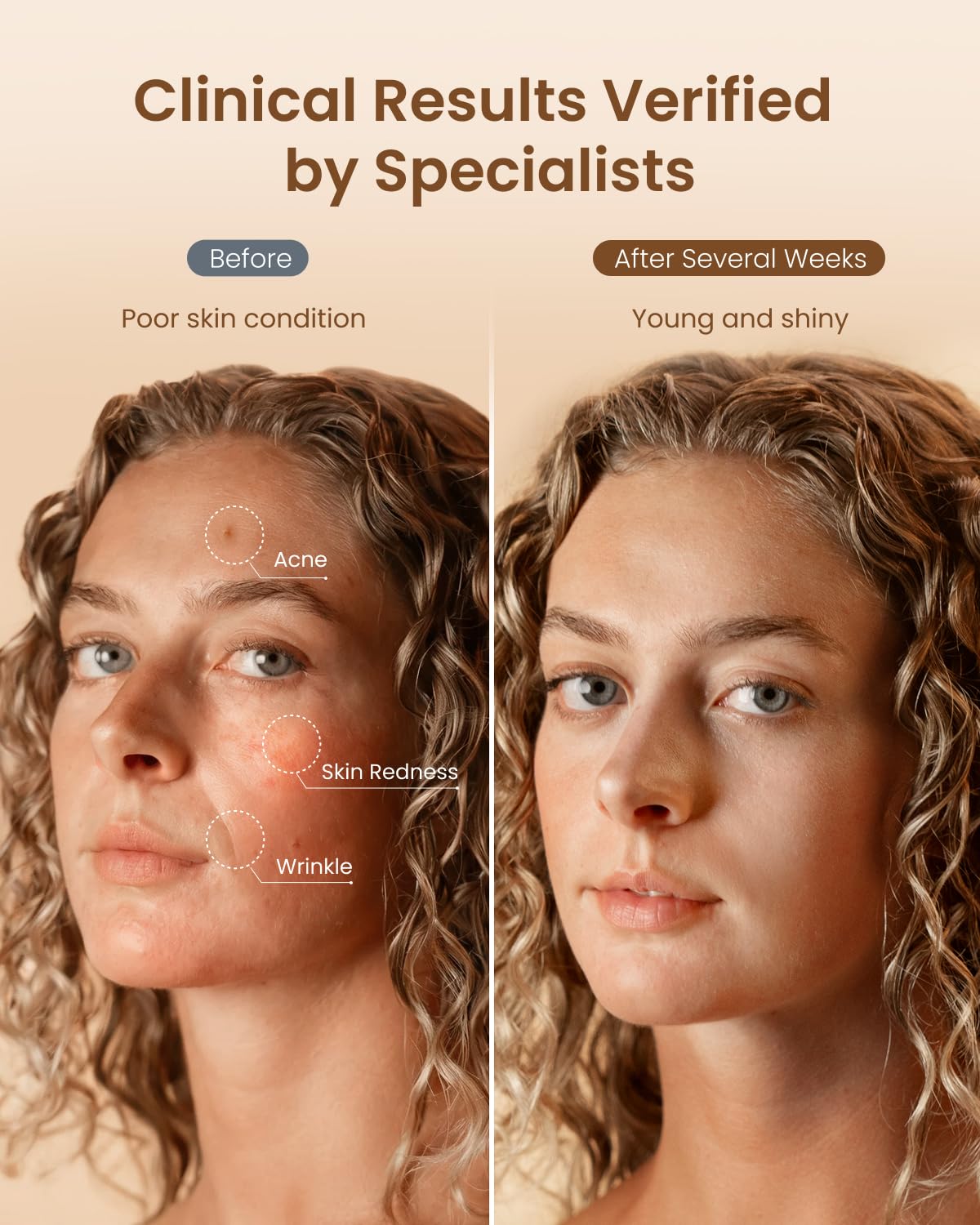 RENPHO Masque sans fil, utilisation nomade pratique lors de déplacements.