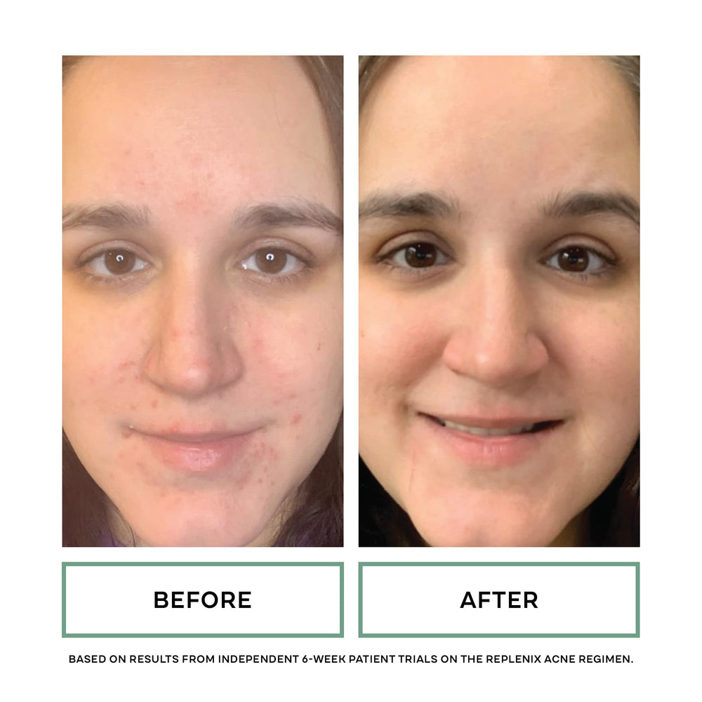 Replenix – Aloe vera visible sur l’emballage, sensation de fraîcheur apaisante.