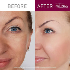 Livaura Retinol : exfoliation-quotidienne révèle un teint plus frais et lumineux