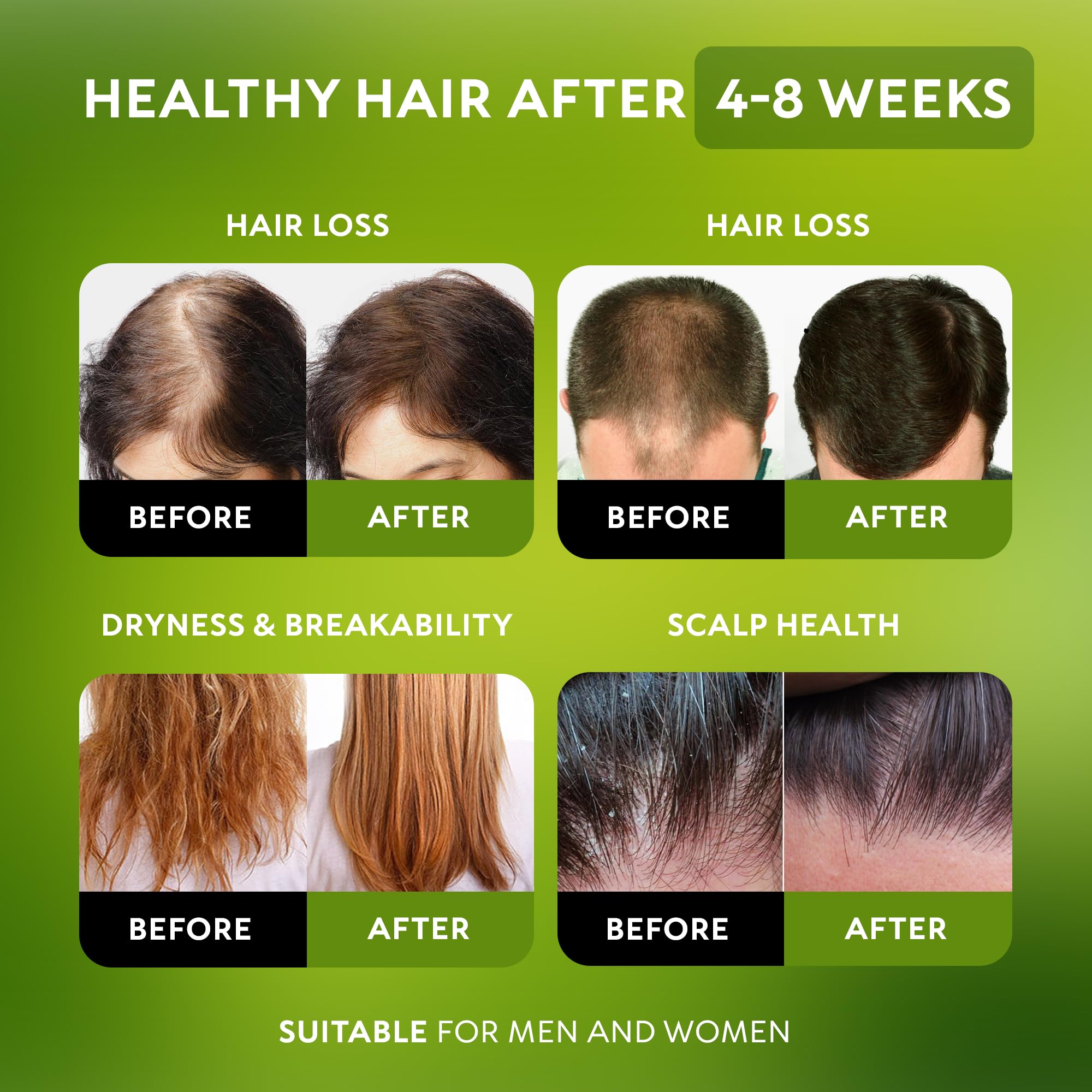 RICHGRAND huile de Batana — texture légère nourrissante pour les cheveux.