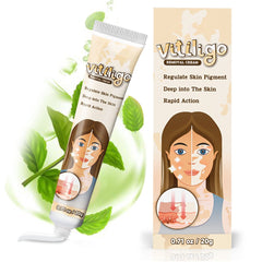Richie House Vitiligo Cream, flacon: application douce hydratante pour peau sensible.