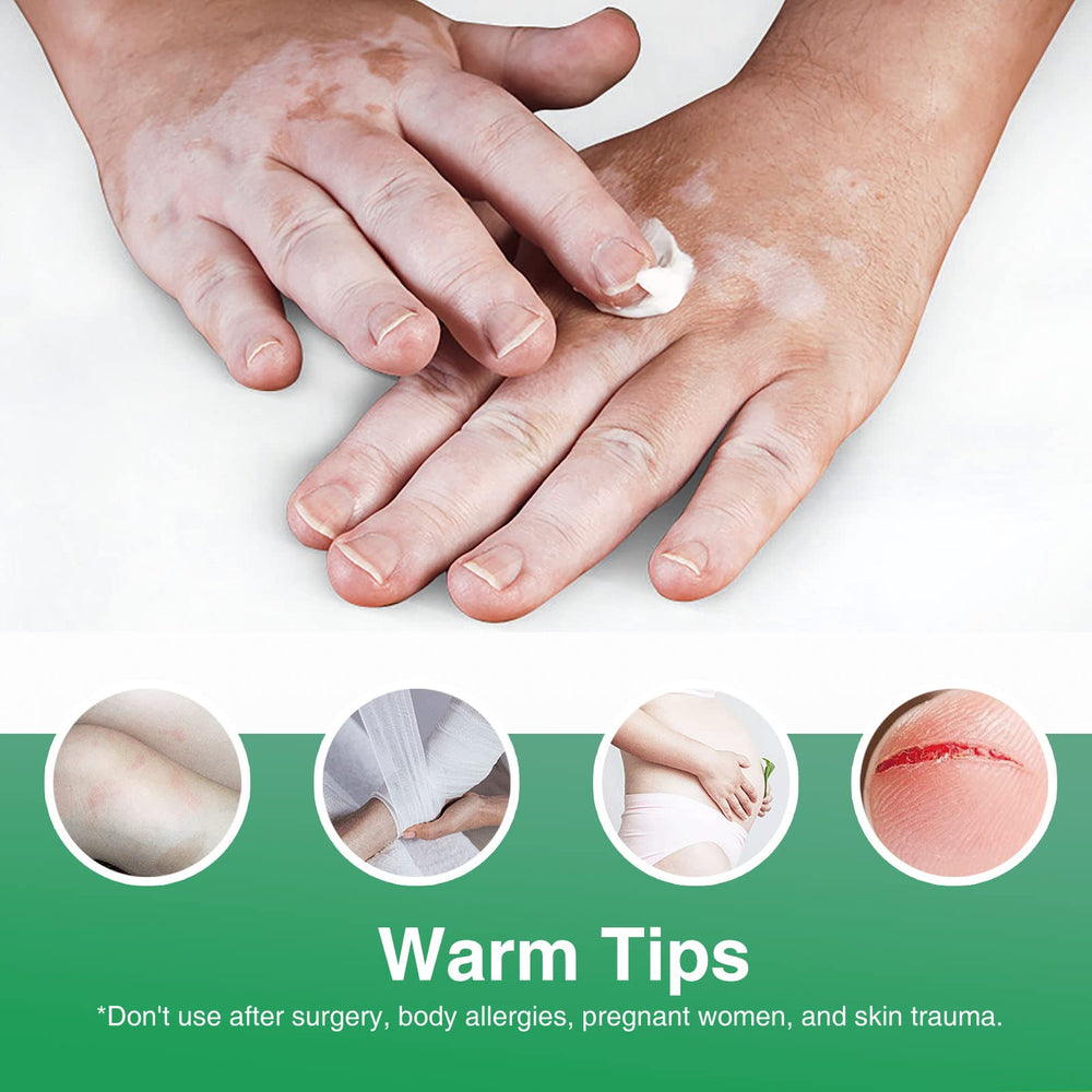 Richie House Vitiligo Cream, ingrédients naturels nourrissants pour la peau.