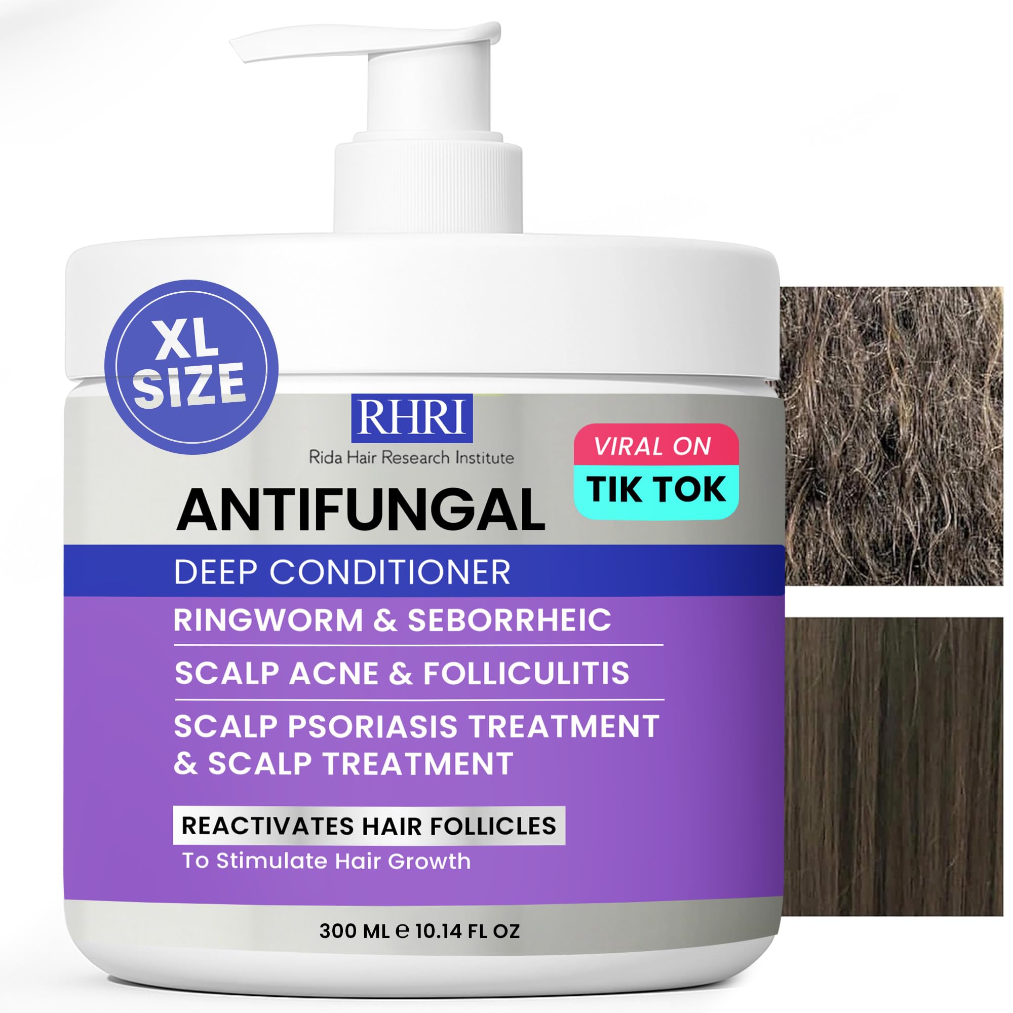 Rida Neoketramin: conditionneur antifongique en bouteille, favorise un cuir chevelu sain.