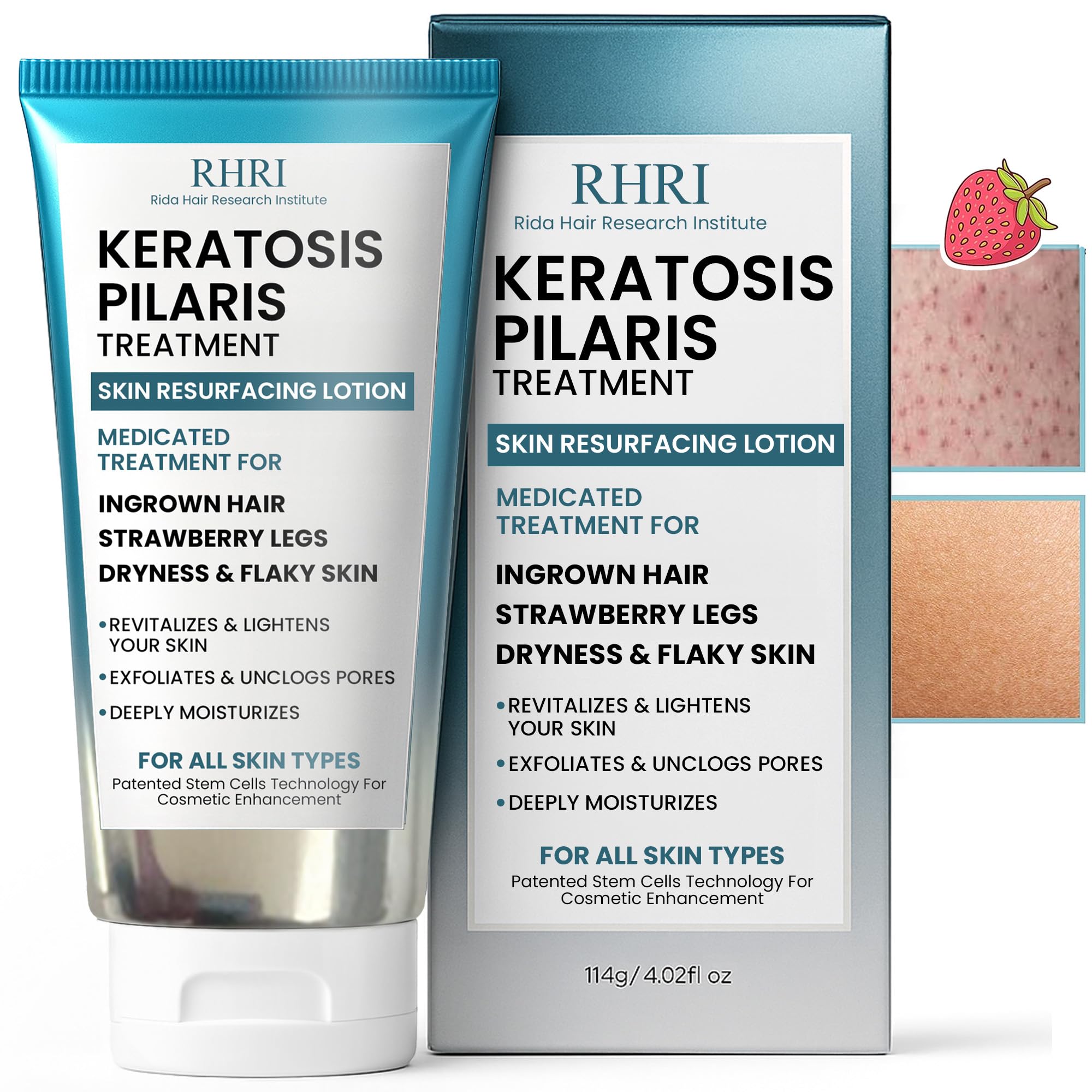 Rida Traitement keratose pilaire, bouteille, hydrate durablement la peau sèche.