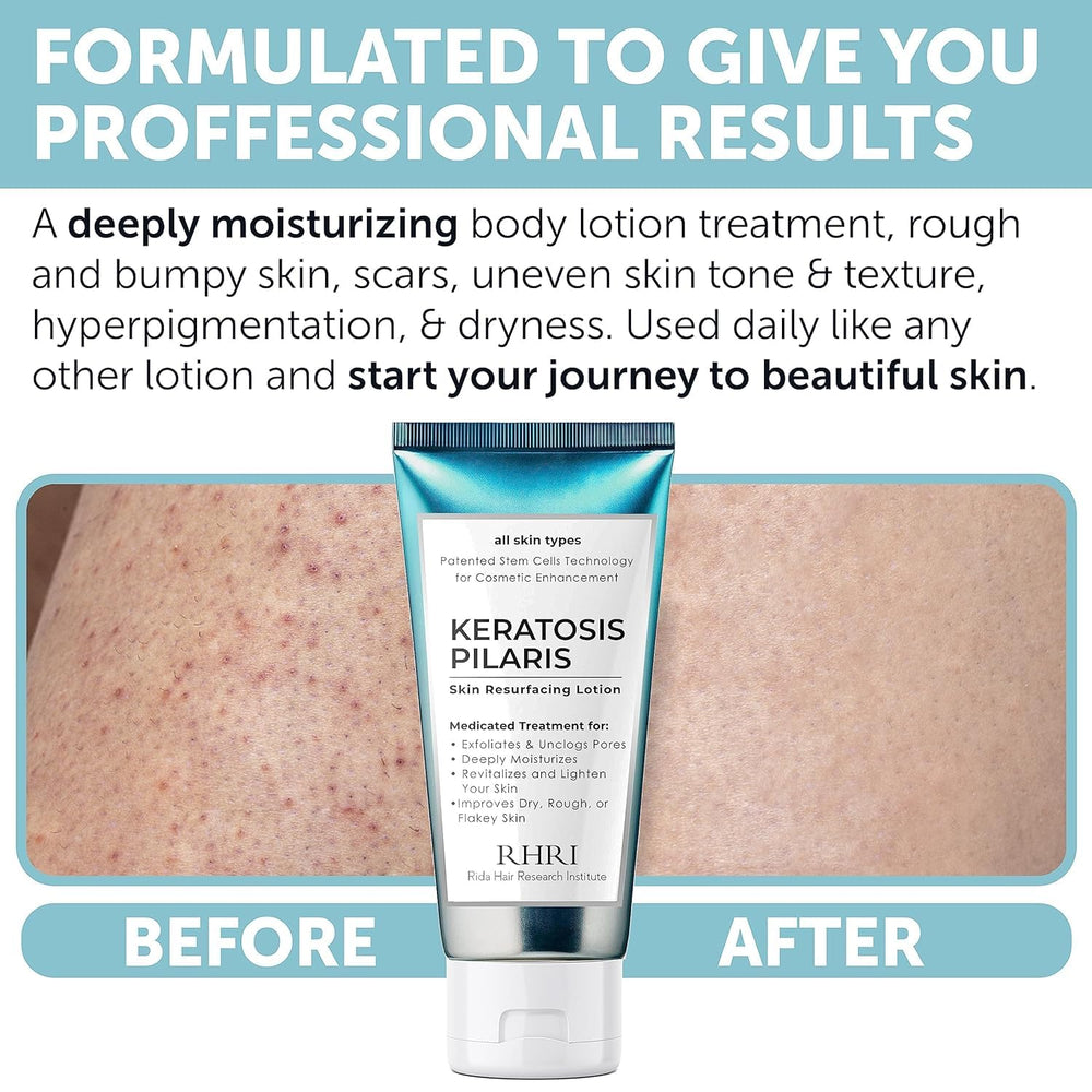 Api Rida Jaz Rida Hair Research Institute — Traitement kératose pilaire, Lotion 10% ...