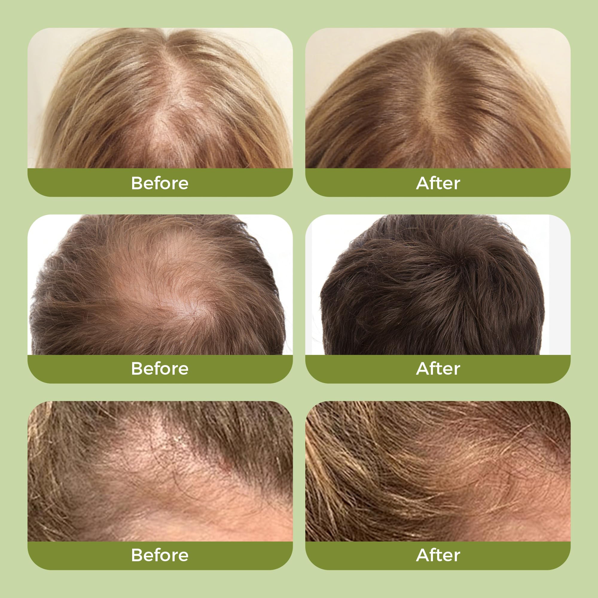 Sans silicone Rinlus, nettoyage doux pour tous types de cheveux.