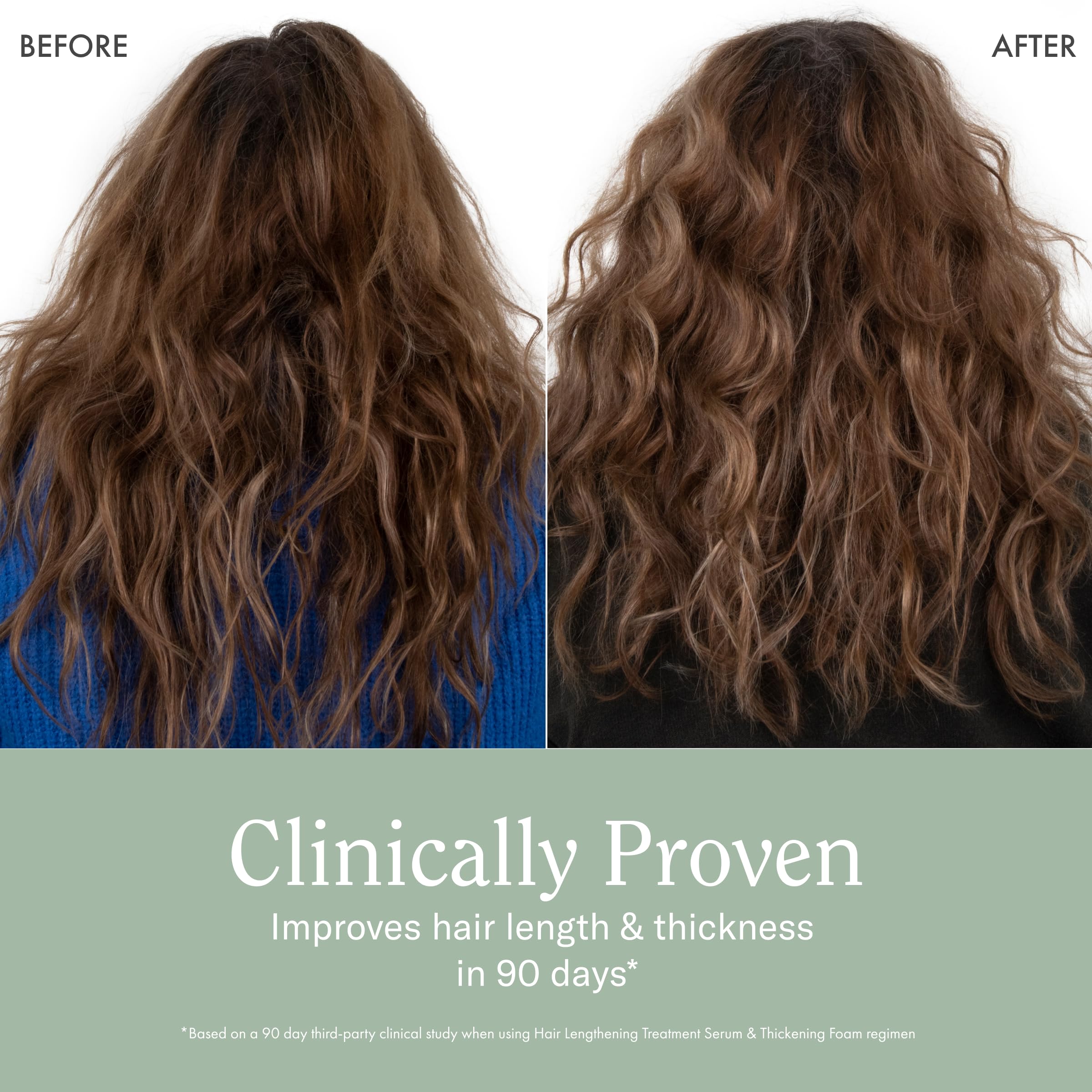 Rizos Curls – Saw Palmetto et curcuma pour cuir chevelu sain