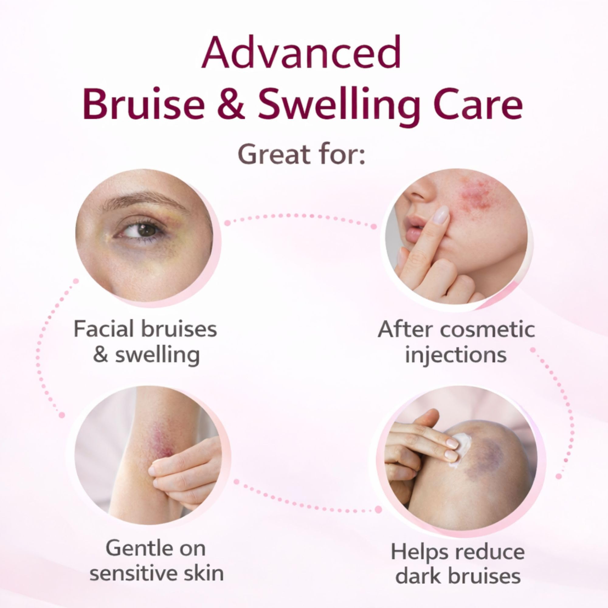 RMCYDS Crème contre les ecchymoses – texture nongrasse et absorption rapide.