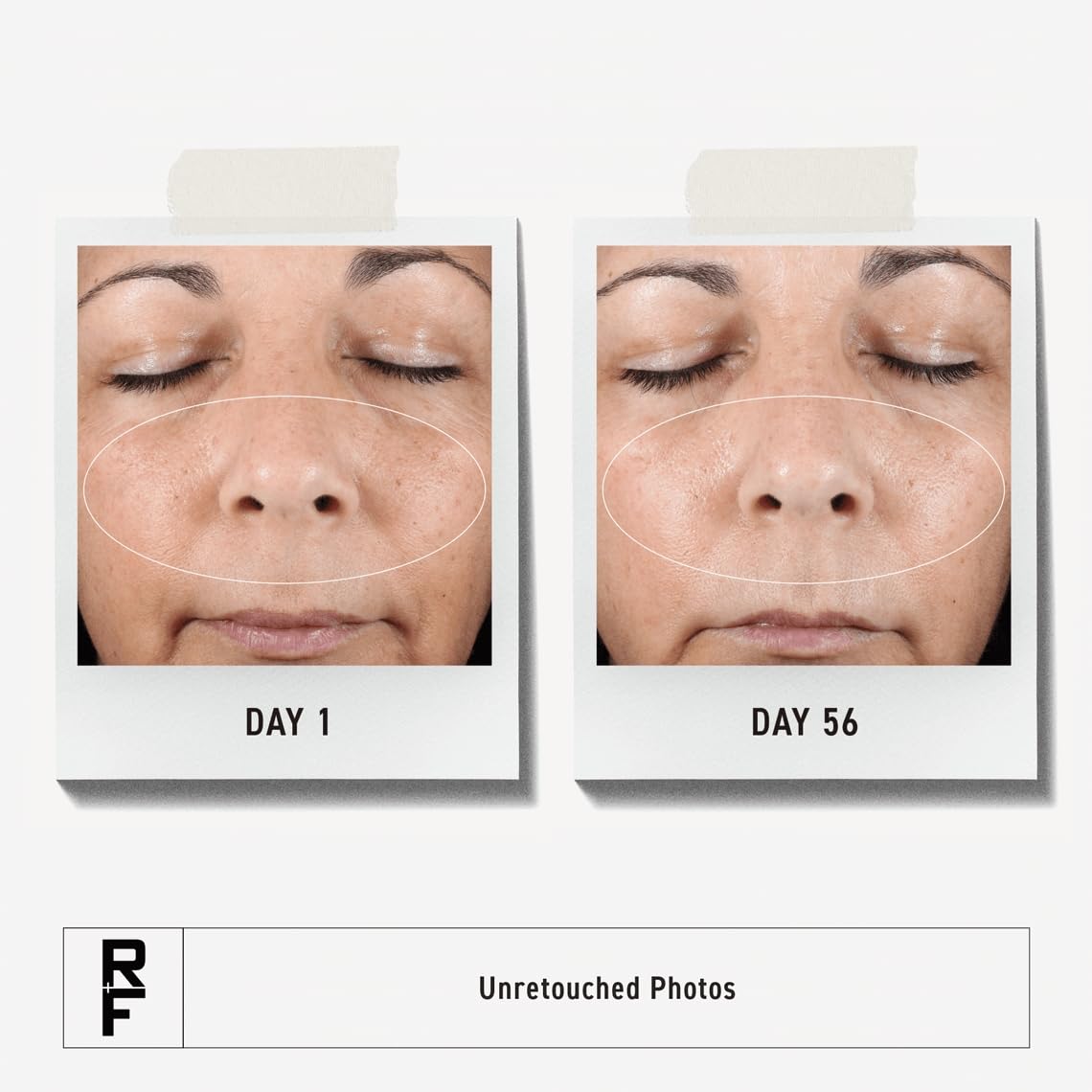 RODAN + FIELDS Active Hydration Serum – pipette, application précise de l'hydratation.