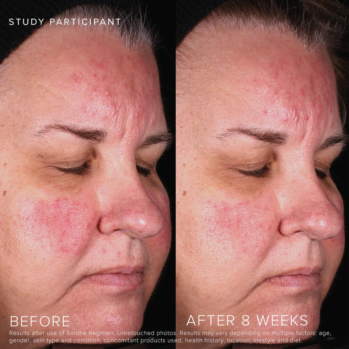 Rodan + Fields Soothe Gel Nettoyant – rinçage facile, sensation de fraîcheur.