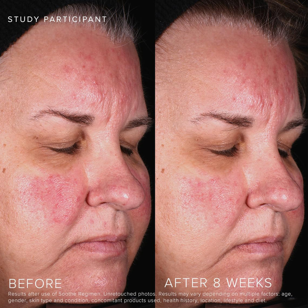Rodan + Fields Soothe Gel Nettoyant – rinçage facile, sensation de fraîcheur.