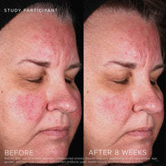 Rodan + Fields Soothe Gel Nettoyant – rinçage facile, sensation de fraîcheur.