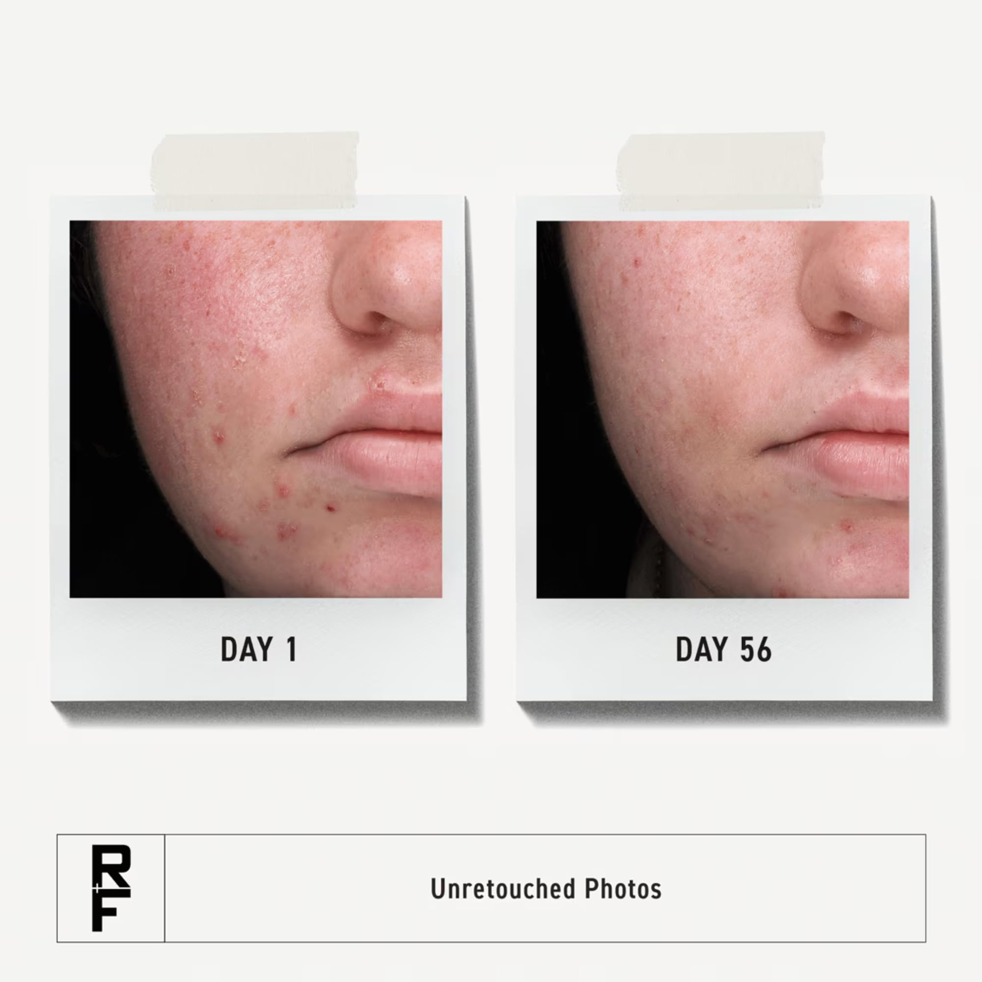 Rodan + Fields Spotless nettoyage-profonds-des-pores, purifie et resserre les pores.