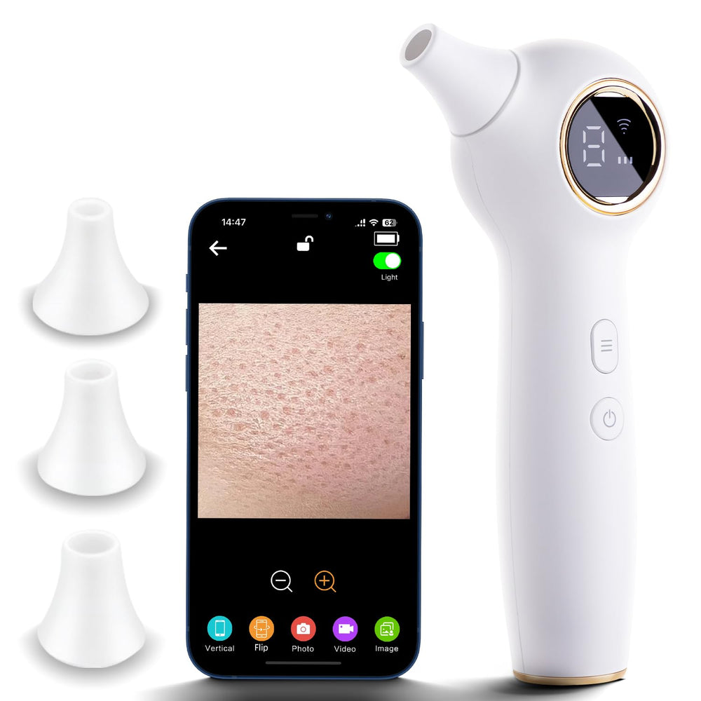 RONEFY extracteur de points noirs avec caméra pour un nettoyage précis des pores.