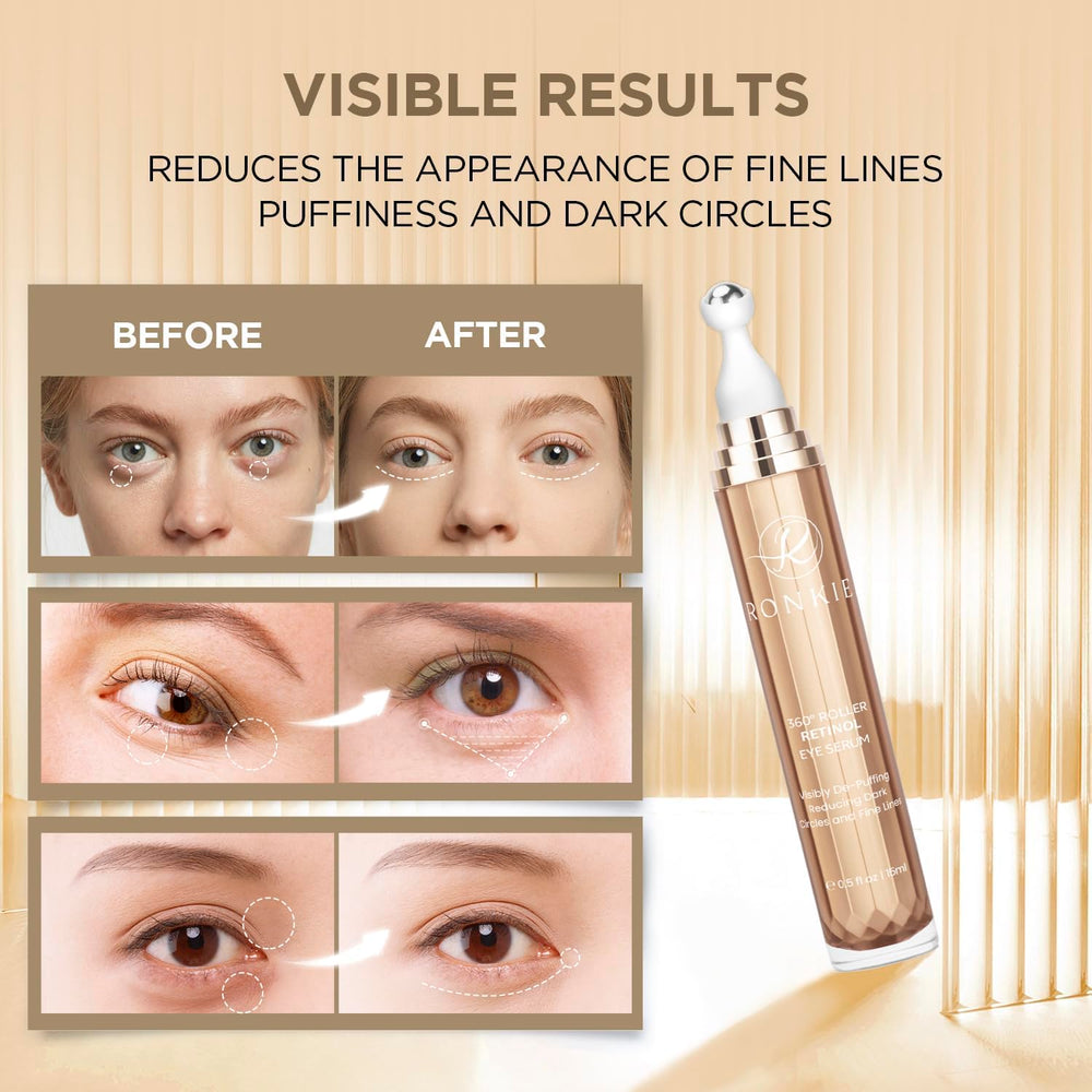 RONKIE Crème Yeux Caféine – anti-poches pour un regard éveillé.