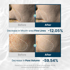 ROOTIO Masque hydrogel hydratation profonde, douceur pendant le sommeil.