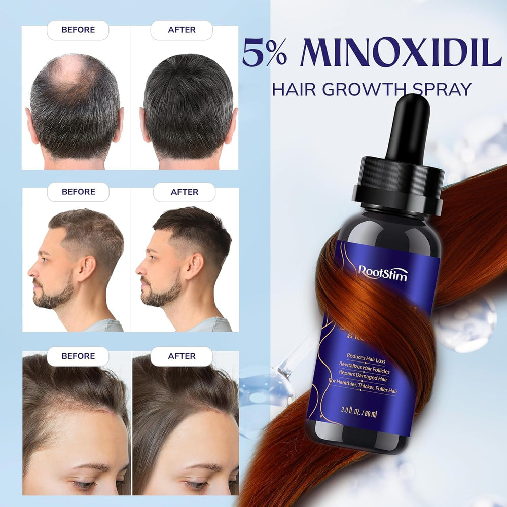 RootStim beard-area application showing support for beard fullness.