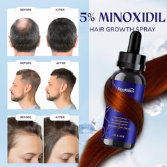 RootStim beard-area application showing support for beard fullness.