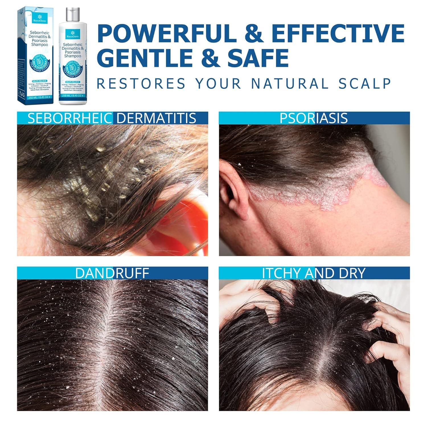 Roycederm Shampoo Extraits-Herbales: ingrédients naturels soutenant le confort du cuir chevelu.