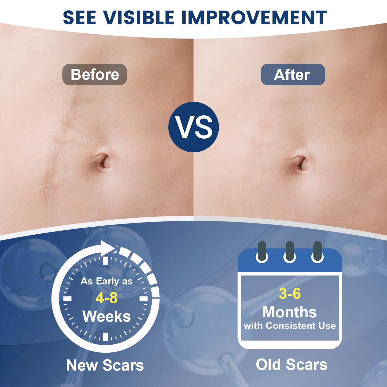 Rvlaim Gel Scar, hydratation profonde, peau plus souple et lisse.